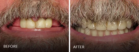 Full, even arch of teeth.